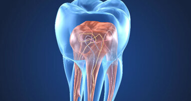 Da dove iniziare? Il bagaglio minimo per un endodontista