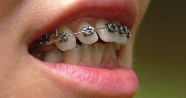 How can hygienists ‘straighten up’?