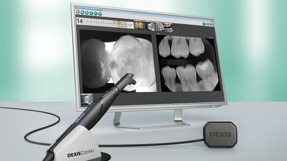 DEXIS presents ‘the best’ in action