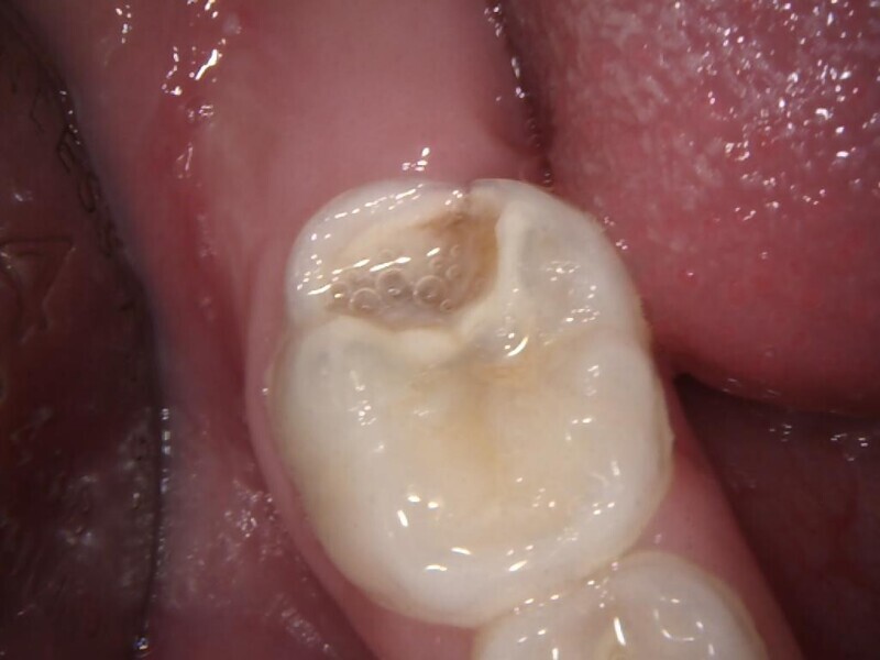 Fig. 1 : Situation initiale.