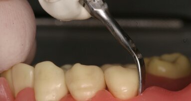 Στρατηγικές για εργονομική χρήση των εργαλείων ριζικής απόξεσης