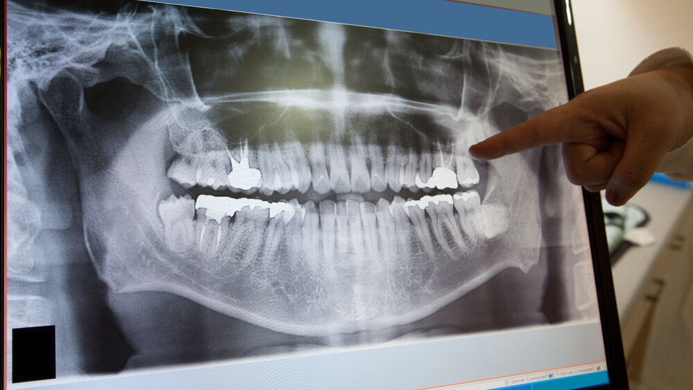 Τρόποι με τους οποίους η ψηφιακή ακτινογραφία θα βελτιώσει την καθημερινή κλινική πράξη