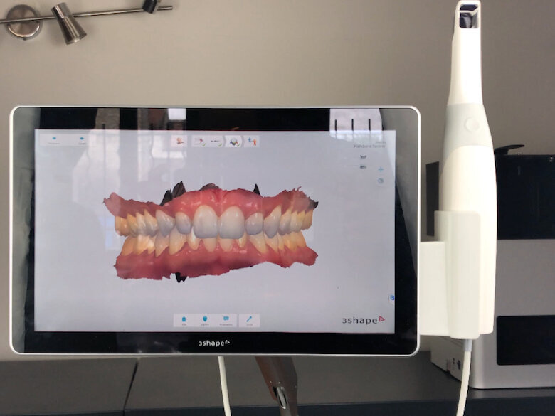 Fig. 15. Imagen del modelo captada con el escáner 3Shape.