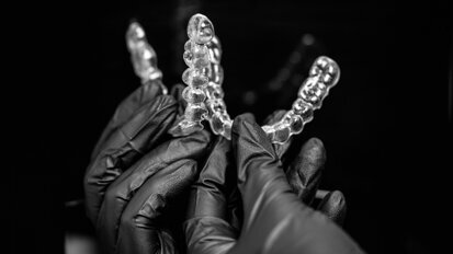 The digital aligner revolution