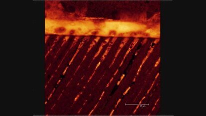 Fortbildung: Aktuelle Entwicklungen auf dem Adhäsivmarkt im Fokus Fortbildung: Aktuelle Entwicklungen auf dem Adhäsivmarkt im Fokus