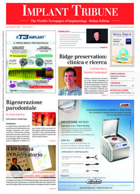 Implant Tribune Italy No. 3, 2013 Implant Tribune Italy No. 3, 2013
