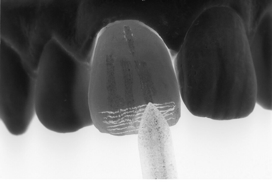 Fig. 14 - Intreccio di linee orizzontali.