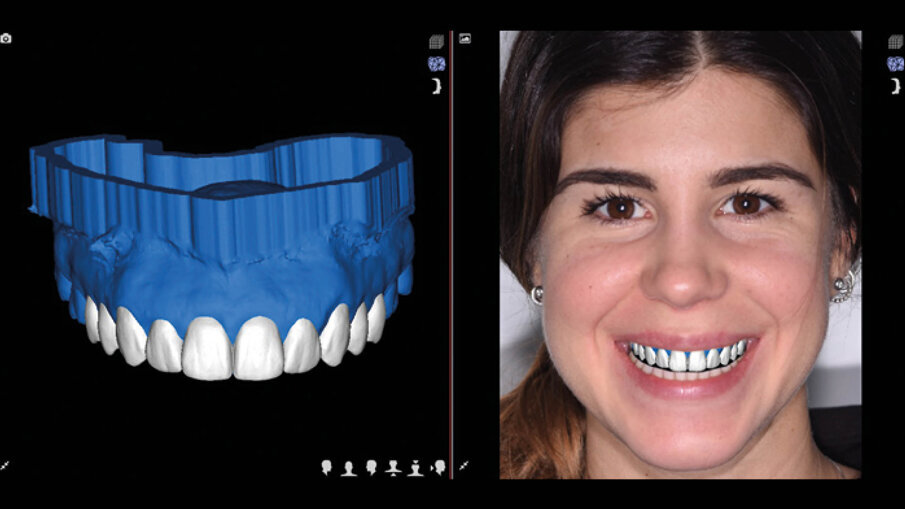 Fig. 7_Pre-visualizzazione dopo DSD.