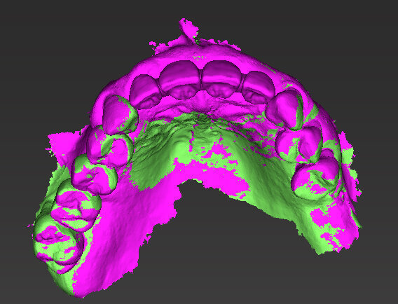 Fig. 9 - Visione occlusale ceratura.