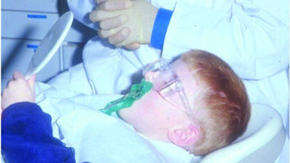 The Hall Technique: The novel method in restoring the carious primary molar