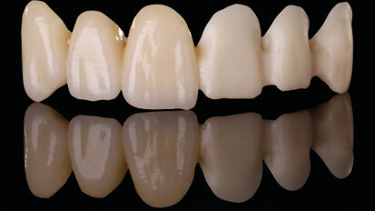 Anatomic Coloured : des blocs teintés dans la masse pour travailler encore plus vite et précisément