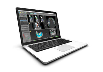 Straumann coDiagnostiX