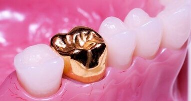 Declina la domanda delle lavorazioni in oro