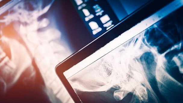 Rischi da Raggi-X: monito delle autorità tedesche agli espositori asiatici di IDS