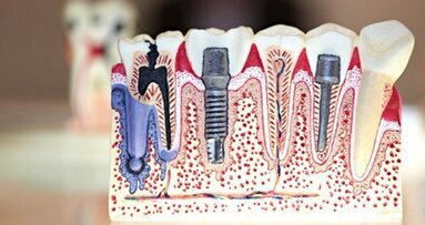 Haben Sozialhilfeempfänger  Darlehensanspruch beim Zahnersatz?