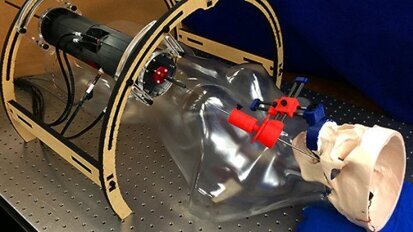 Hersenchirurgie via de wang