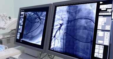 高危人群的定期肺癌CT扫描有助于头颈部癌症的早期诊断