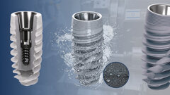 IDL Uni-Platform: A conical approach to implant–abutment connections
