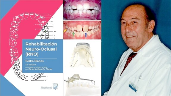 Por una actualización de la Rehabilitación Neurooclusal de Pedro Planas
