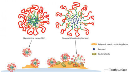 Nanopartikel im Kampf gegen Karies