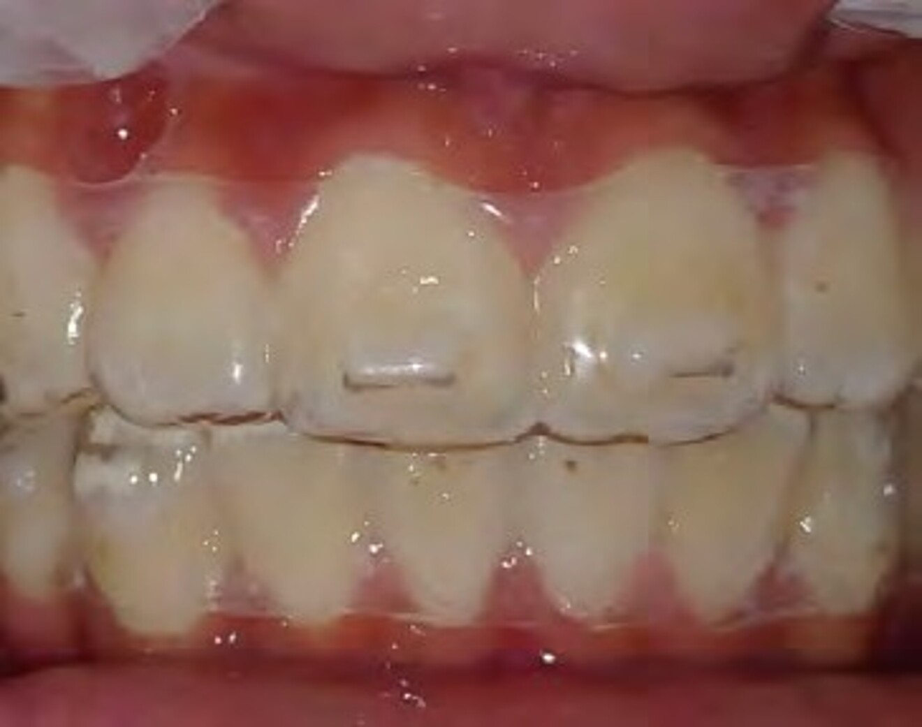 2i