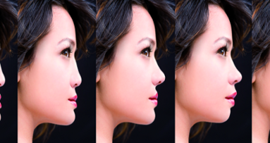 Smile analysis and photoshop smile design technique