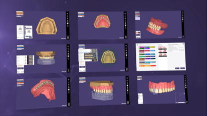 exocad – DentalCAD 2.4 Plovdiv