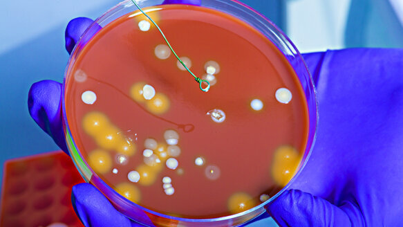 Study: Bib clips can harbor bacteria even after disinfection