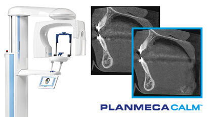 Imagistică excelentă cu unitățile CBCT de la Planmeca
