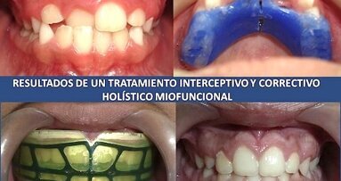 El Dr. Arturo Alvarado sobre el Diplomado Internacional en Ortopedia Craneofacial