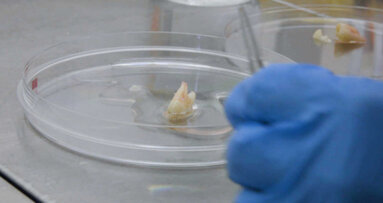 Des chercheurs étudient la possibilité de repousse de dents