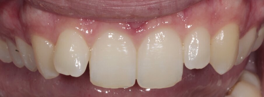 3. Close-up initiële situatie