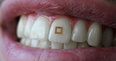 Microchip op tand meet inname suiker, zout en alcohol