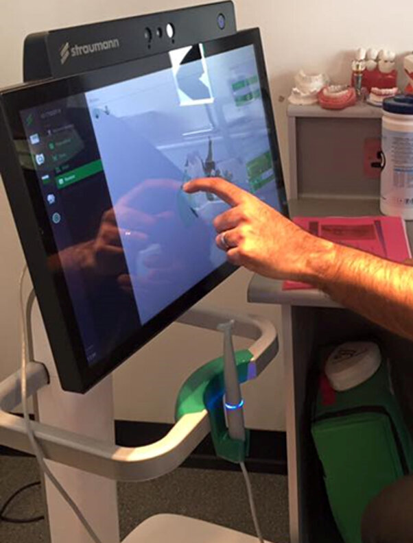 Fig. 1: Dental Wings intraoral scanner.