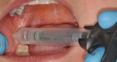 Porównanie metod znieczulenia przewodowego nerwu zębodołowego dolnego – badania własne