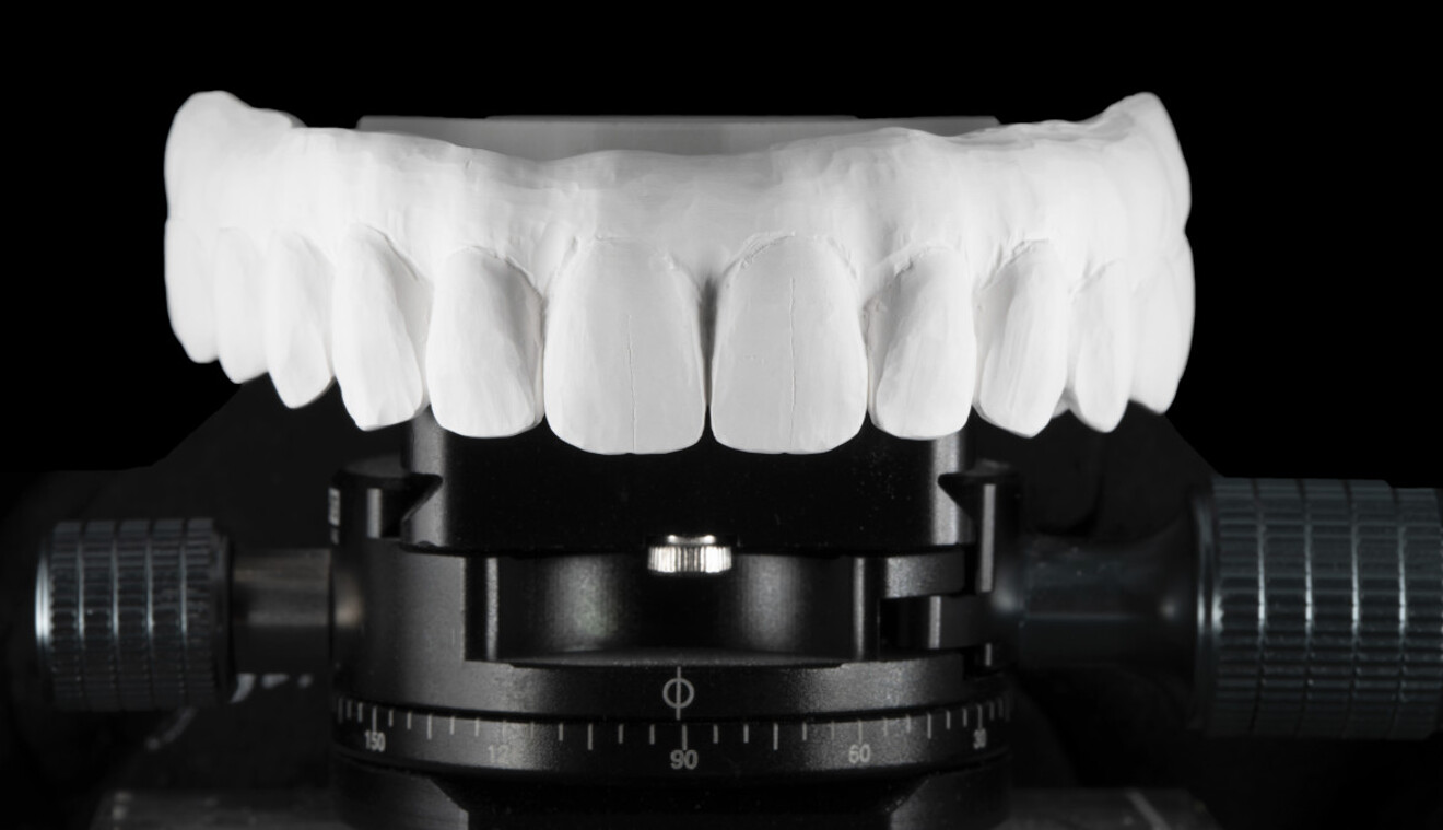 Fig. 7: Zirconia framework after removal from the disk and manual cutback.