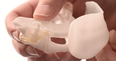 La postura de la lengua en los trastornos del sueño