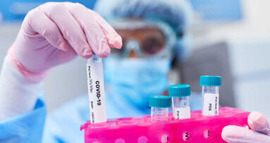 Teste de saliva para SARS-CoV-2 decola