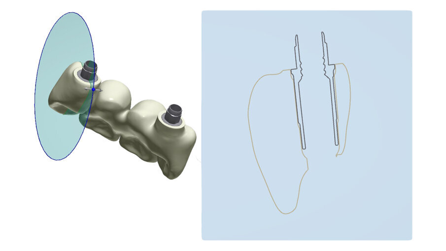 Fig. 40_Anche la scelta dell’altezza del t-base è un’altra determinate al manufatto finale.