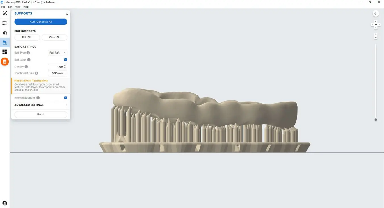 Fig. 3: Design of an occlusal splint with supporting structures.