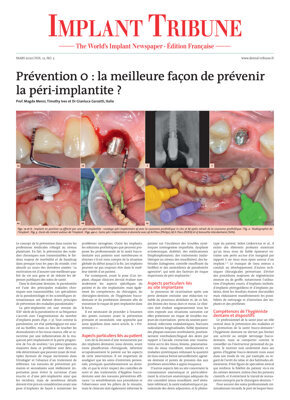 Implant Tribune France No. 2, 2020