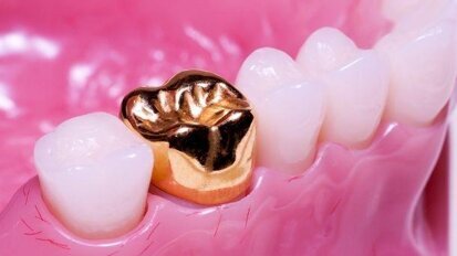 Declina la domanda delle lavorazioni in oro