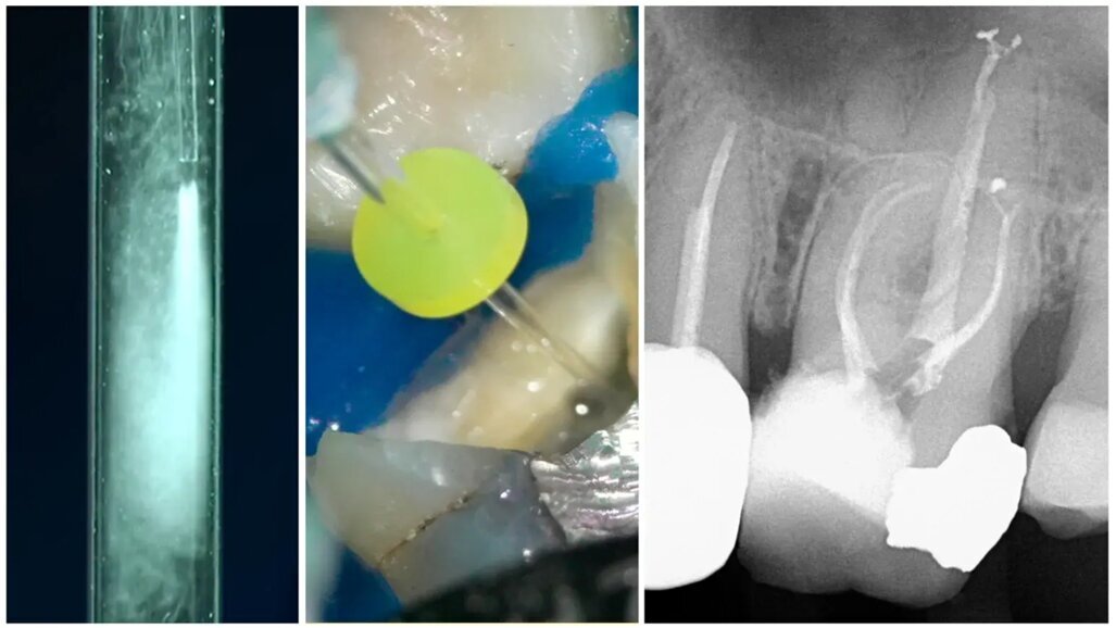 Първият Odne Summit отбелязва успешното приключване на програмата за приоритетен достъп до OdneClean