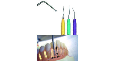 Innovative Kürettenserie