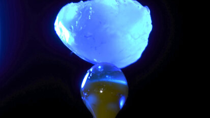 Dientes supernumerarios