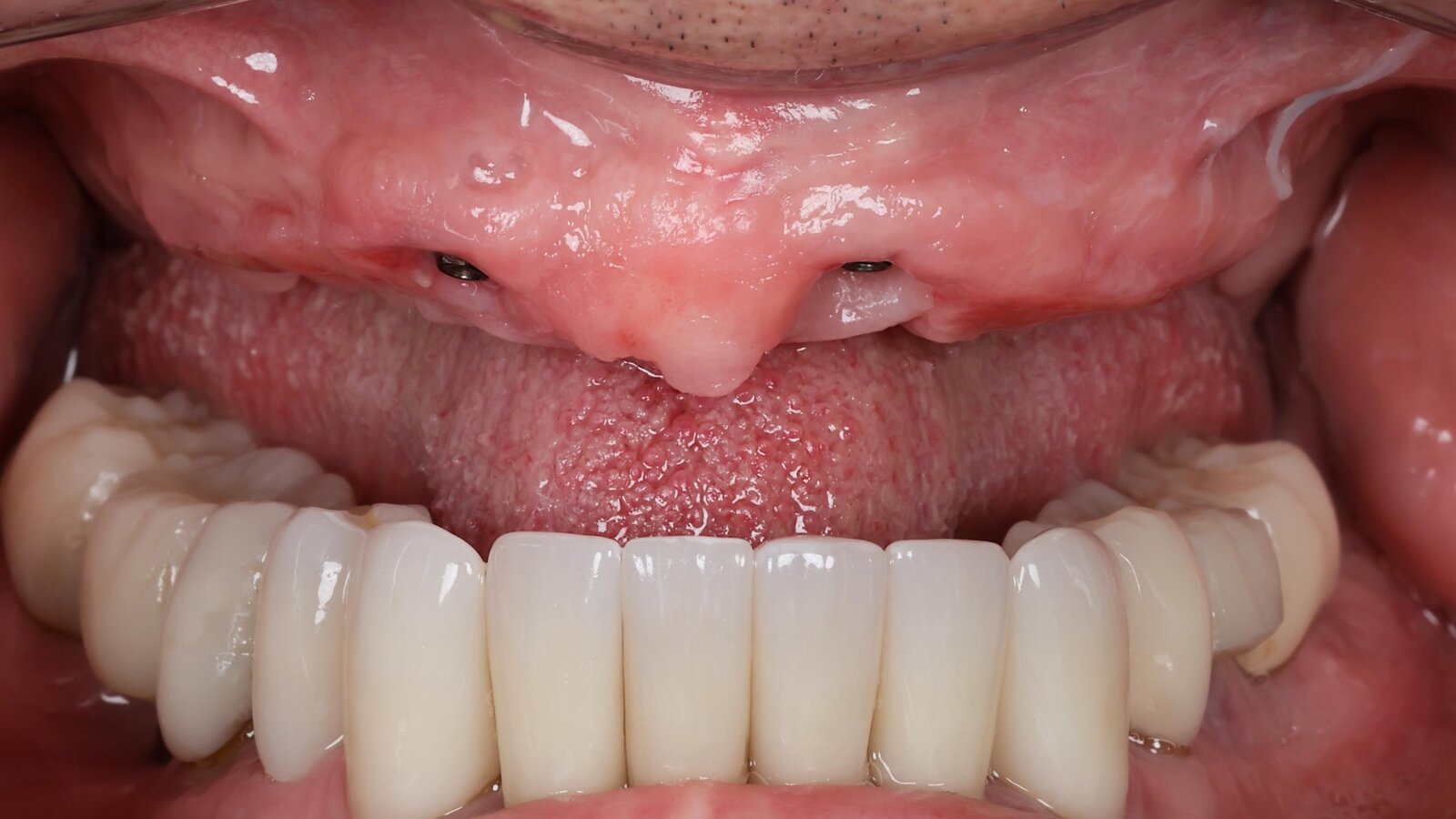 ¿Qué es, cómo funciona y para qué sirve la fotogrametría?