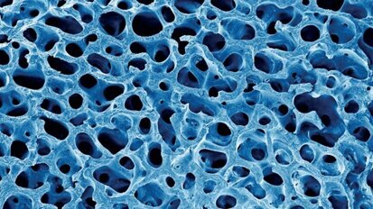 Biological and physical properties of bone block grafting biomaterials for alveolar ridge augmentation