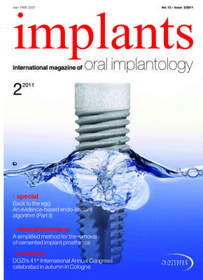 implants international No. 2, 2011 implants international No. 2, 2011