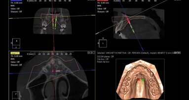 Il workflow digitale per la correzione della discrepanza trasversale: un case report