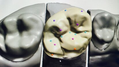 Modelacija krunice - manuelno ili digitalno?